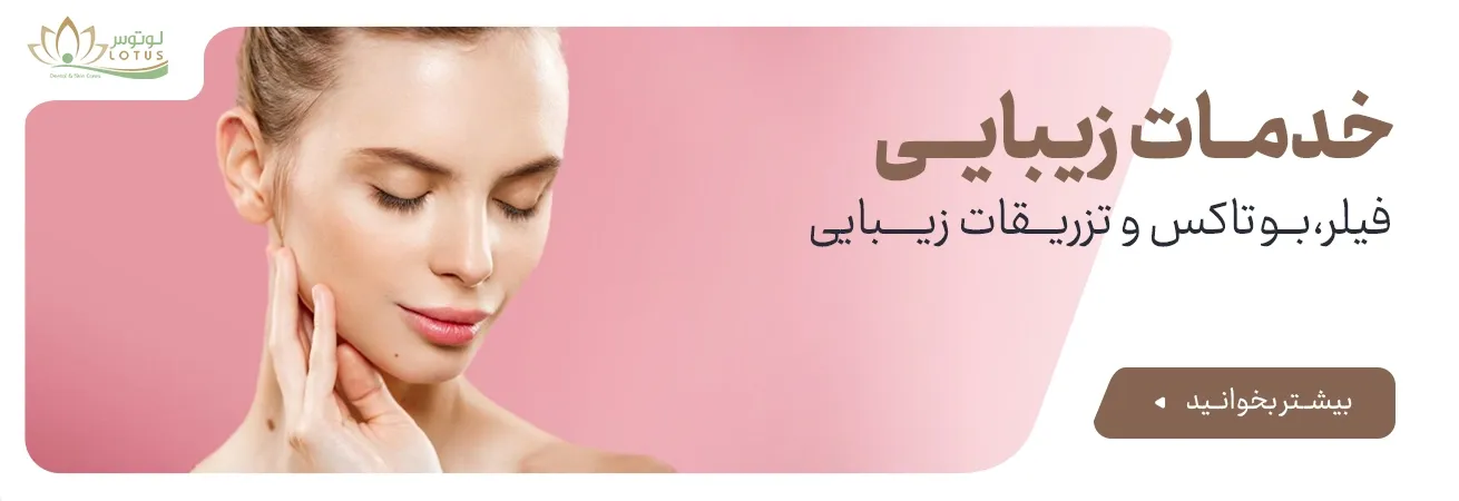 یک زیبایی تمام عیار میهمان ما باشید